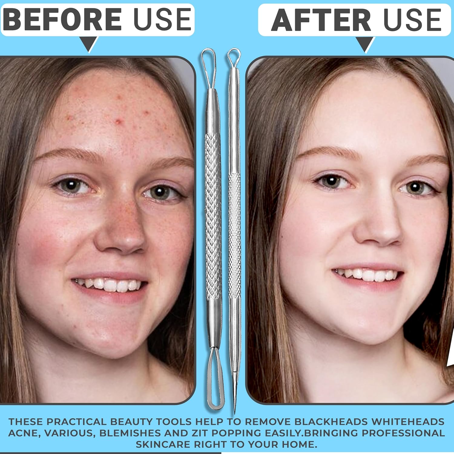 ClearSteel Pimple Fixer Tool Kit